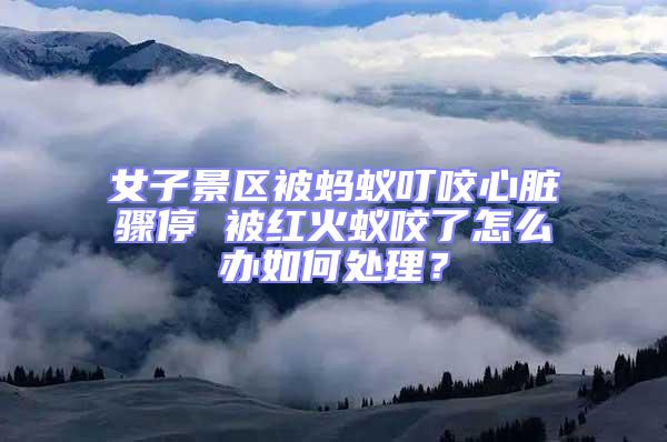 女子景區被螞蟻叮咬心臟驟停 被紅火蟻咬了怎么辦如何處理？